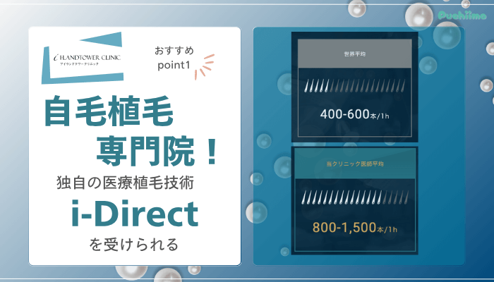 アイランドタワークリニックFAGAおすすめポイント1