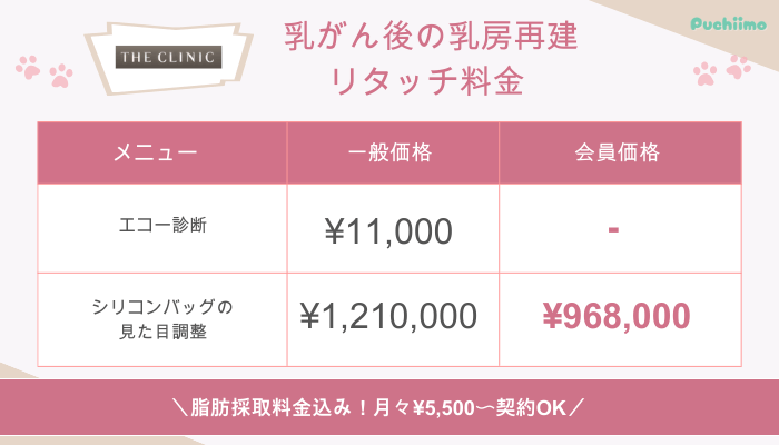 ザクリニック豊胸乳がん後の乳房再建リタッチ料金