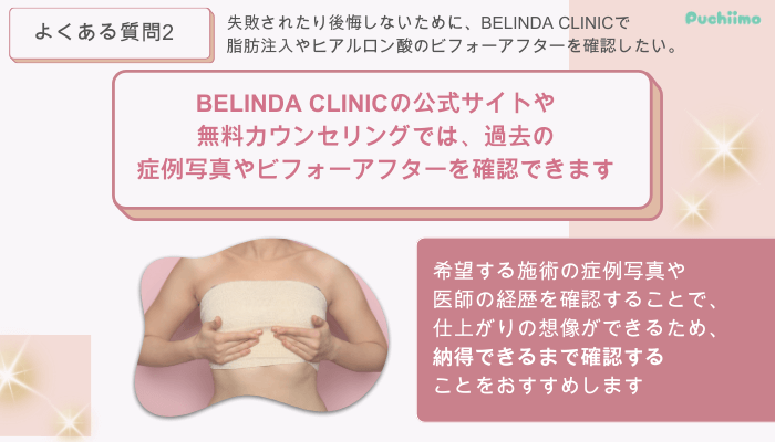 ベリンダクリニック豊胸よくある質問2