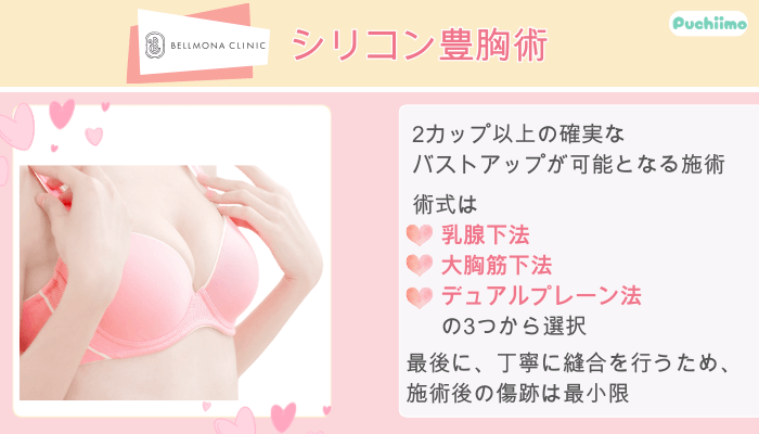 ベルモナクリニックシリコン豊胸術