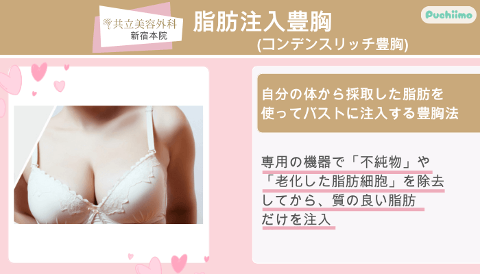共立美容外科新宿脂肪注入豊胸コンデンスリッチ豊胸