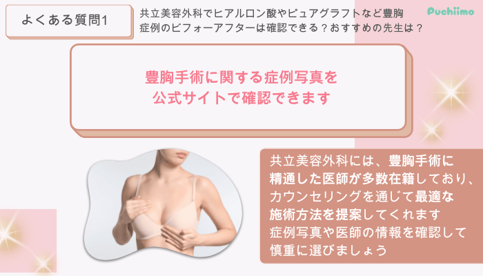 共立美容外科豊胸よくある質問1