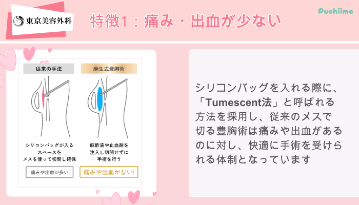 東京美容外科東美式シリコンバッグ豊胸特徴1