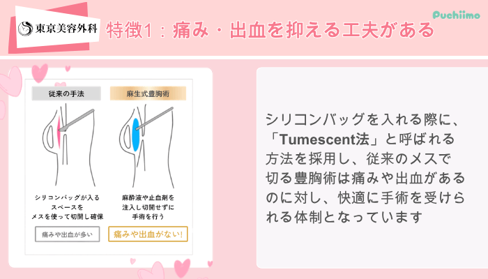 東京美容外科東美式シリコンバッグ豊胸特徴1