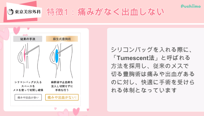 東京美容外科東美式シリコンバッグ豊胸特徴1