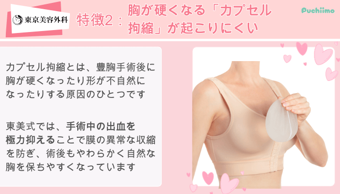 東京美容外科東美式シリコンバッグ豊胸特徴2