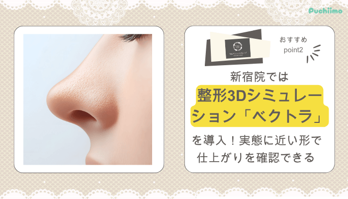TAクリニック鼻整形おすすめポイント2