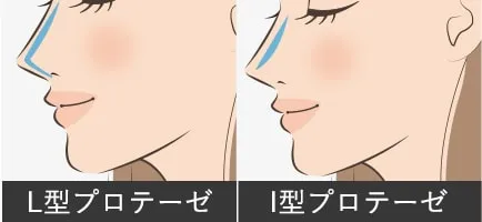 TA隆鼻術プロテーゼ