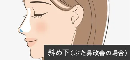 TA鼻尖4Dノーズ