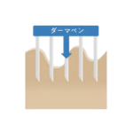 エミナルクリニックダーマペン仕組み1