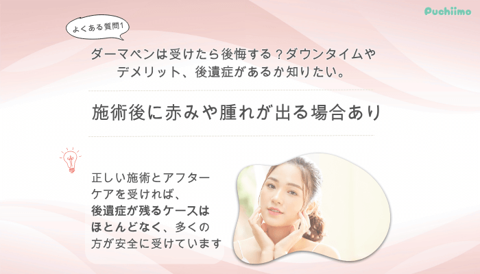 クリニックフォアダーマペンよくある質問1