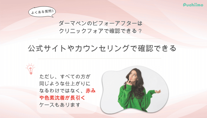 クリニックフォアダーマペンよくある質問3