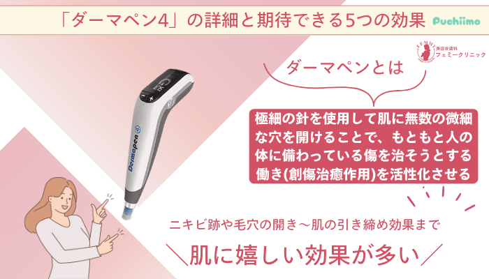 フェミークリニックダーマペンの詳細と期待できる5つの効果