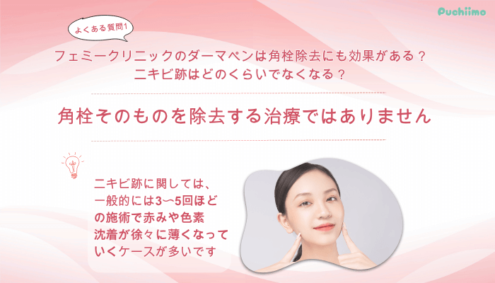 フェミークリニックダーマペンよくある質問1