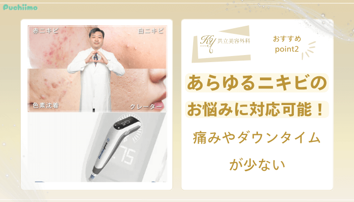 共立美容外科ダーマペンおすすめポイント2