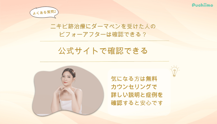 共立美容外科ダーマペンよくある質問2