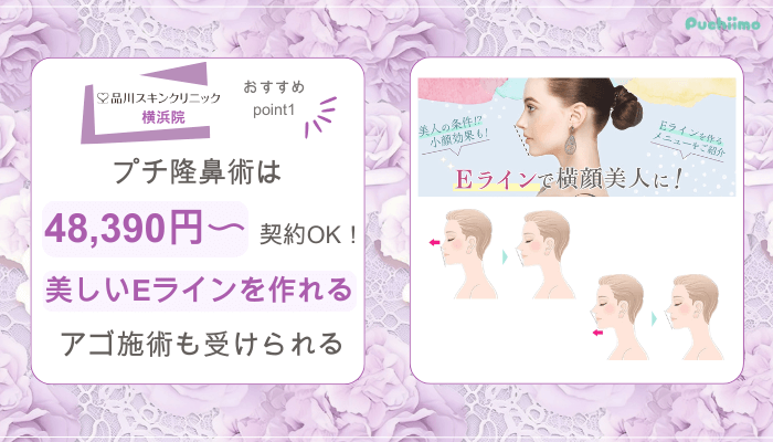 品川スキンクリニック横浜鼻整形おすすめポイント1