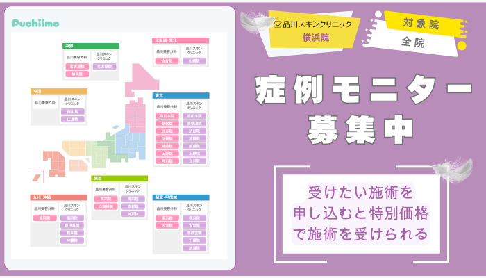 品川スキンクリニック横浜鼻整形各院で症例モニター募集中