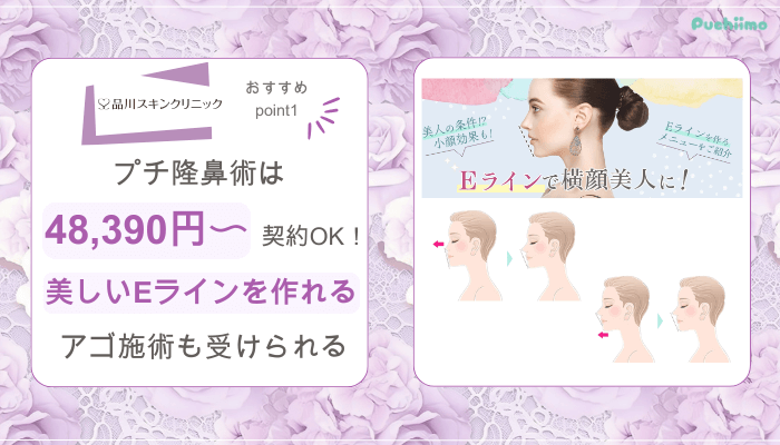 品川スキンクリニック鼻整形おすすめポイント1