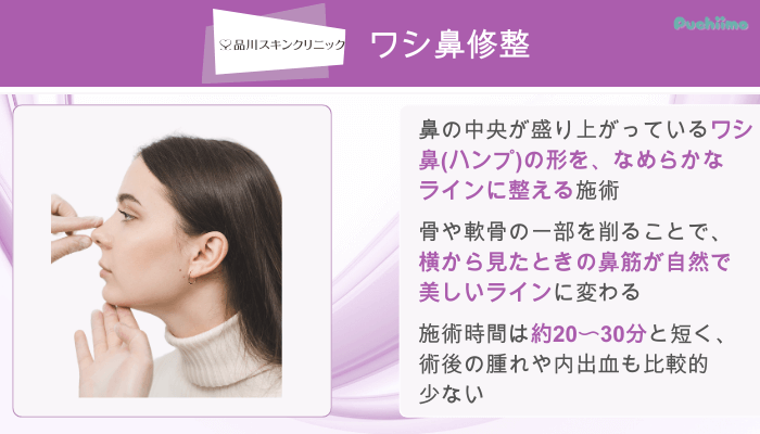 品川スキンクリニック鼻整形ワシ鼻修整