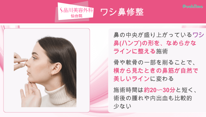 品川美容外科仙台鼻整形ワシ鼻修整