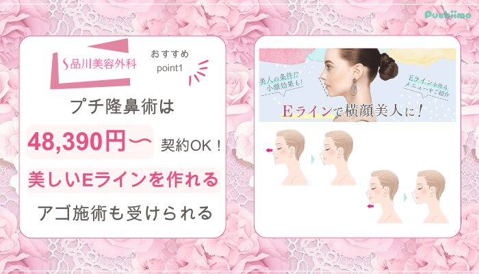 品川美容外科鼻整形おすすめポイント1