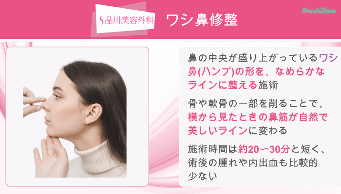 品川美容外科鼻整形ワシ鼻修整