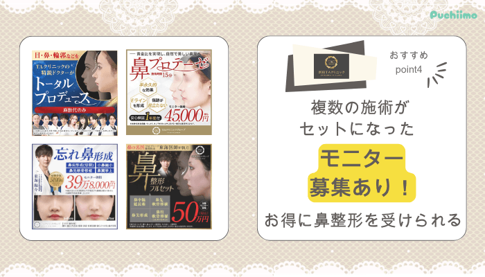 新宿TAクリニック鼻整形おすすめポイント4