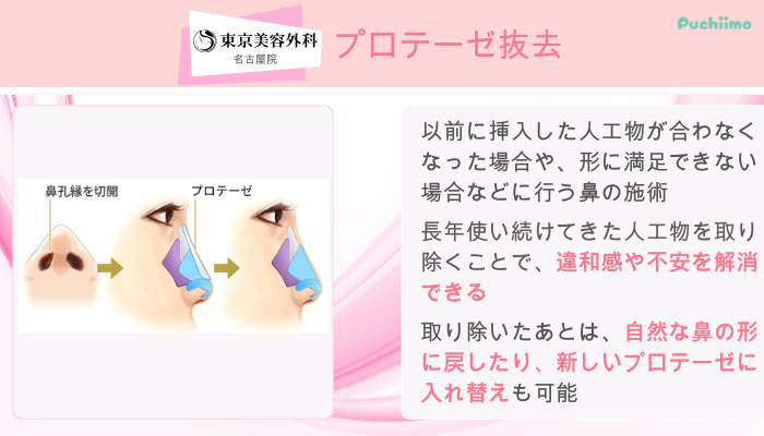 東京美容外科名古屋鼻整形プロテーゼ抜去
