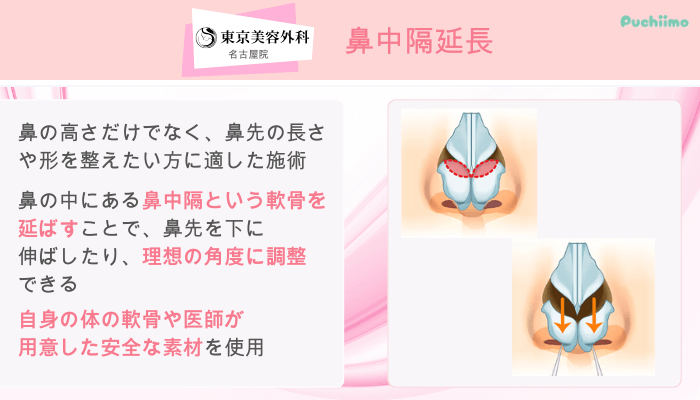 東京美容外科名古屋鼻整形鼻中隔延長