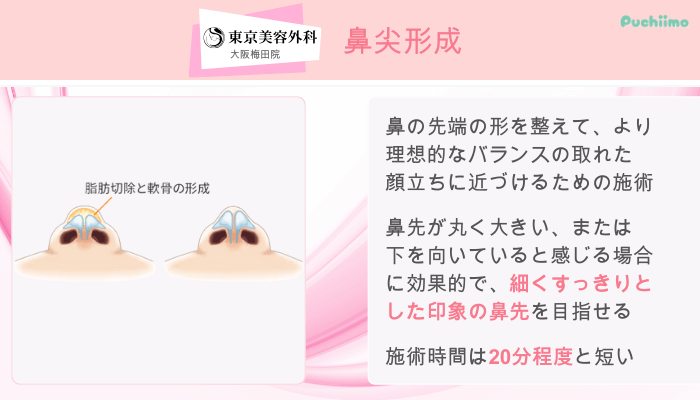 東京美容外科大阪梅田鼻整形鼻尖形成