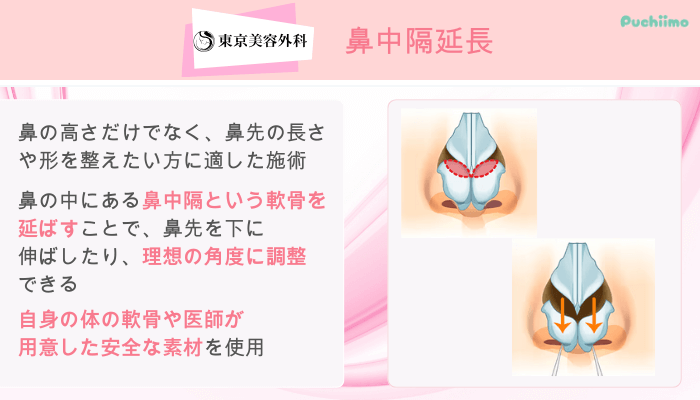東京美容外科鼻整形鼻中隔延長