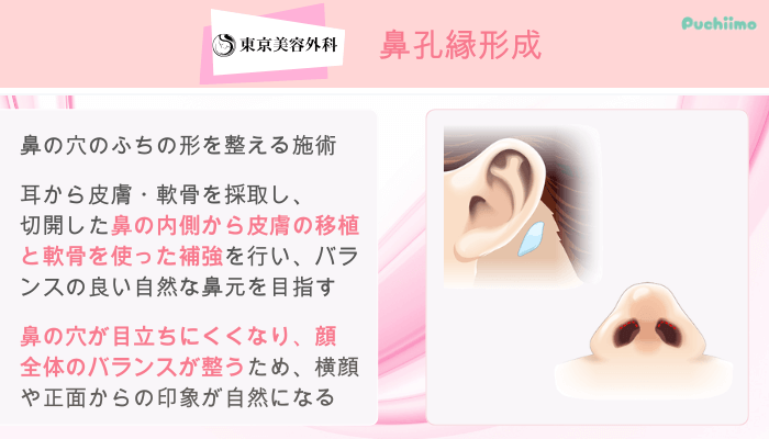 東京美容外科鼻整形鼻孔縁形成