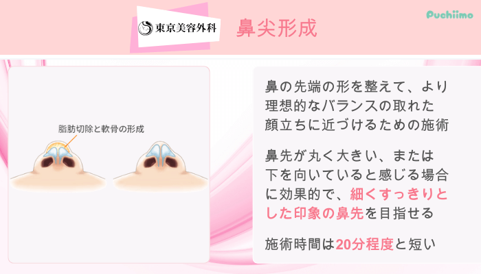 東京美容外科鼻整形鼻尖形成