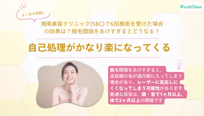 SBC医療脱毛よくある質問2