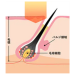 SBC比較用美容脱毛