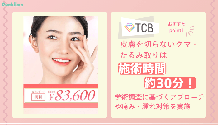 TCBクマ取りおすすめポイント1