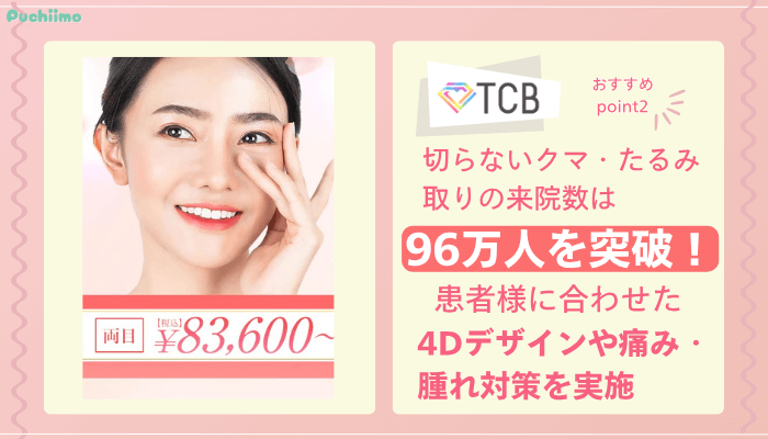TCBクマ取りおすすめポイント2