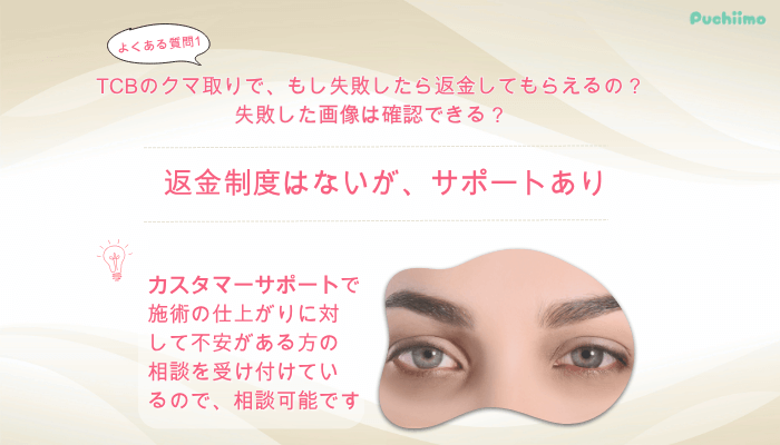 TCBクマ取りよくある質問1