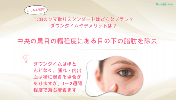 TCBクマ取りよくある質問3