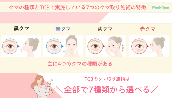 TCBクマ取りクマの種類とTCBで実施している7つのクマ取り施術の特徴