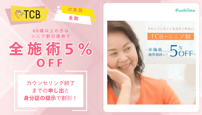 TCBクマ取りシニア割引