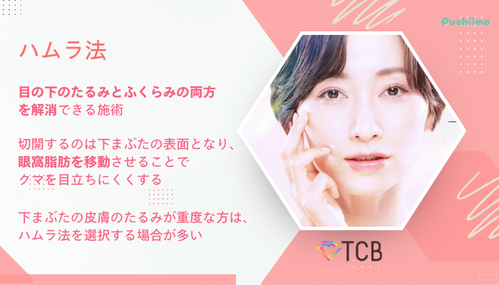 TCBクマ取りハムラ法