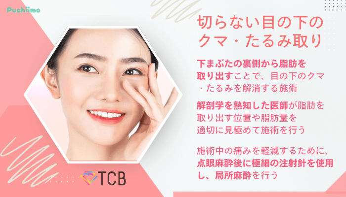 TCBクマ取り切らない目の下のクマ・たるみ取り