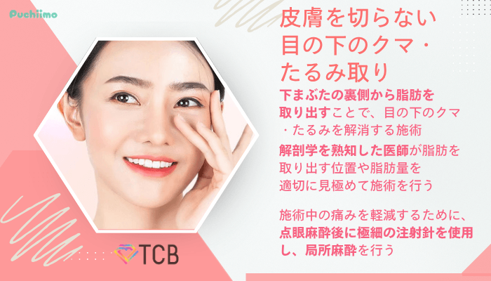 TCBクマ取り皮膚を切らない目の下のクマ・たるみ取り