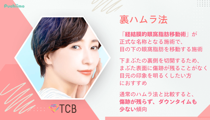 TCBクマ取り裏ハムラ法
