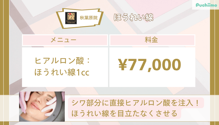やさしい美容皮膚科・皮フ科-秋葉原院ほうれい線