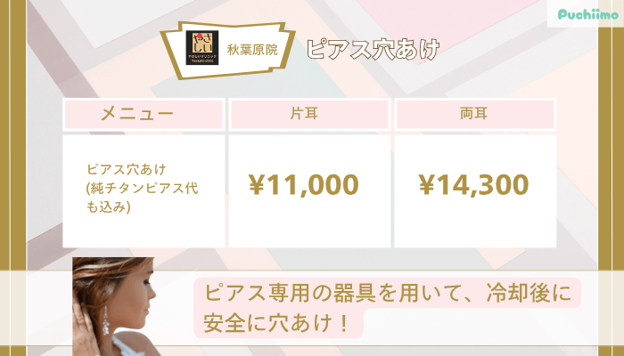 やさしい美容皮膚科・皮フ科-秋葉原院ピアス穴あけ