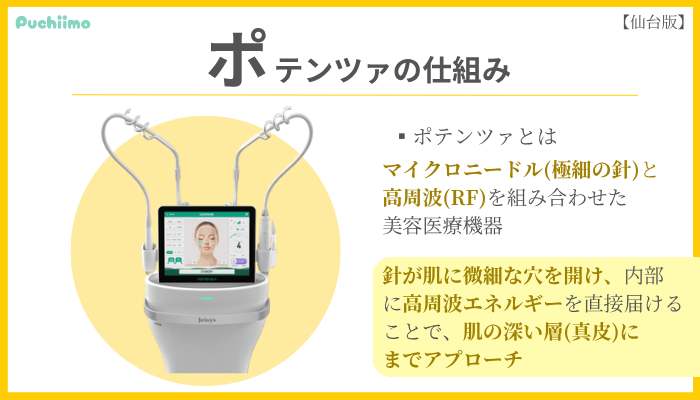 ポテンツァの仕組み仙台