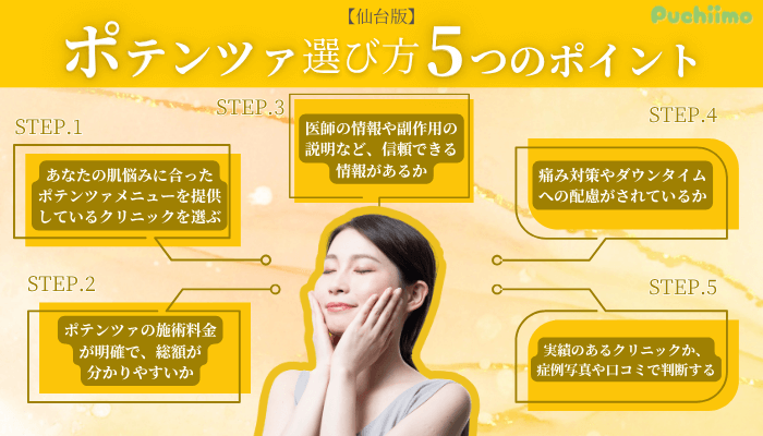 ポテンツァ仙台重視すべき5つのポイント